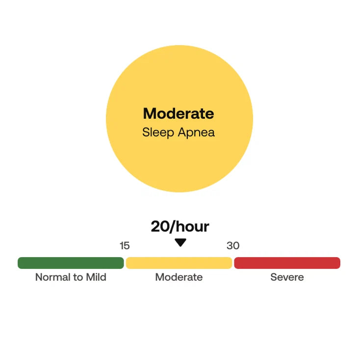Medical-grade sleep apnea detection